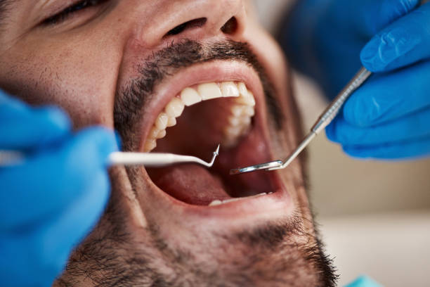 Best Dentist for Tooth Abscess  in North Pekin, IL