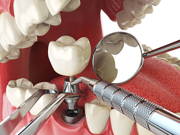 Best Emergency Tooth Extraction  in North Pekin, IL